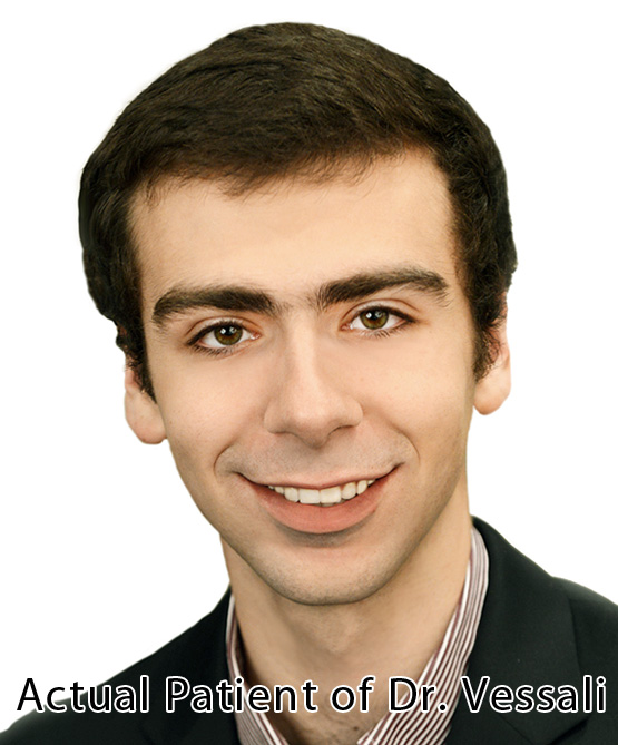 Teeth Whitening in Fairfax, Virginia