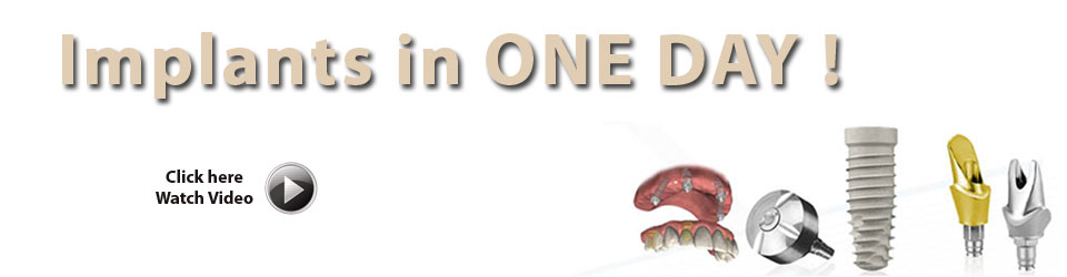 One day implant dentist in Herndon, Mclean, and Fairfax VA.