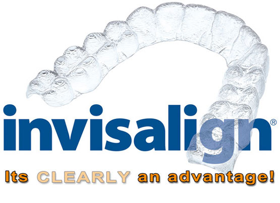 invisalign-01.jpg