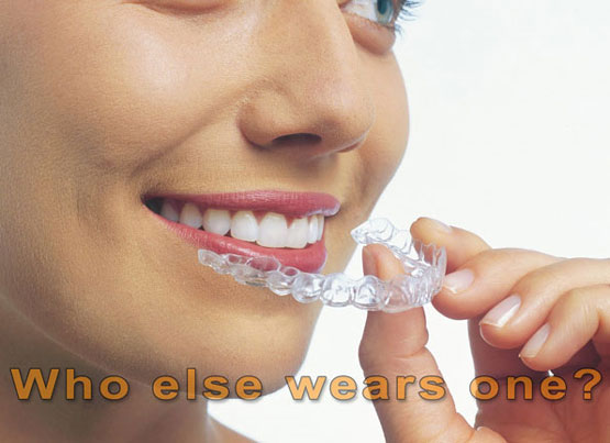 invisalign-02.jpg